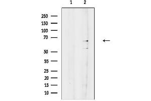 anti-Glutaminase 2 (Liver, Mitochondrial) (GLS2) (N-Term) antibody