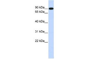 WB Suggested Anti-ZXDA Antibody Titration:  0. (ZXDA Antikörper  (Middle Region))