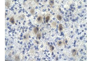 Rabbit Anti-NFKBIA antibody        Paraffin Embedded Tissue:  Human Brain cell   Cellular Data:  Epithelial cells of renal tubule  Antibody Concentration:   4. (NFKBIA Antikörper  (N-Term))