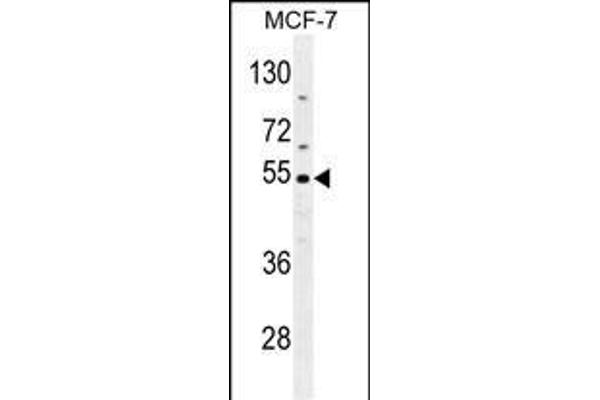 CES2 抗体  (AA 340-369)