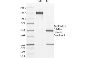 SDS-PAGE Analysis Purified CD171 Mouse Monoclonal Antibody (UJ127). (L1CAM Antikörper)