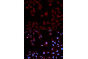 Immunofluorescence analysis of HeLa cells using STAT5B antibody.