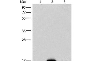 Western blot analysis of Mouse heart tissue Human heart tissue Human muscle tissue lysates using COX6A2 Polyclonal Antibody at dilution of 1:400