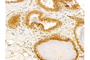 ABIN6259941 and ABIN6273031 at 1/100 staining Human normal tissues adjacent to breast cancer by IHC-P. (Annexin VII Antikörper  (N-Term))