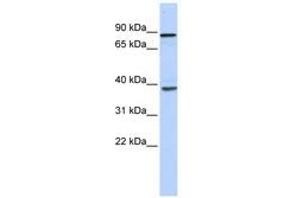 DHX35 抗体  (N-Term)