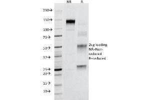 SDS-PAGE Analysis Purified CD95 Mouse Monoclonal Antibody (B-R18). (FAS Antikörper)