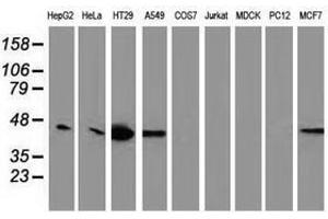 Image no. 2 for anti-Vasodilator-Stimulated phosphoprotein (VASP) antibody (ABIN1501697)