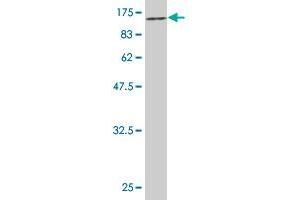 Western Blot detection against Immunogen (85. (CHEK2 Antikörper  (AA 1-543))