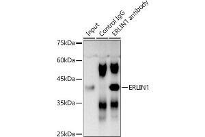 Immunoprecipitation analysis of 300 μg extracts of DU145 cells using 3 μg ERLIN1 antibody (ABIN7267005). (ERLIN1 Antikörper  (AA 259-348))
