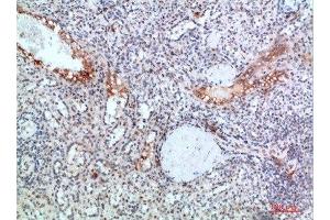 Immunohistochemical analysis of paraffin-embedded human-spleen, antibody was diluted at 1:200 (TICAM1 Antikörper  (AA 663-712))