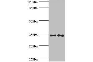 Western blot All lanes: NRBF2 antibody at 5. (NRBF2 Antikörper  (AA 10-220))
