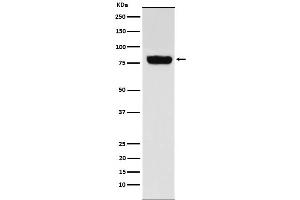 Western blot analysis of SLC22A3 expression in Human muscle cell lysate.