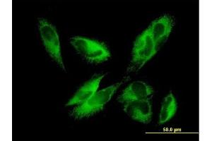 Immunofluorescence of purified MaxPab antibody to EPHX1 on HepG2 cell. (EPHX1 Antikörper  (AA 1-455))