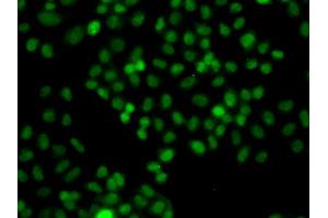 Immunofluorescence analysis of A549 cells using PIP5K1A antibody (ABIN5975757). (PIP5K1A Antikörper)