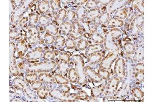 IHC analysis of CBR1 using anti-CBR1 antibody (ABIN7600015). (CBR1 Antikörper  (AA 14-262))