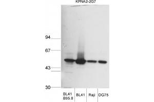 Image no. 1 for anti-Karyopherin alpha 2 (RAG Cohort 1, Importin alpha 1) (KPNA2) (AA 116-515) antibody (ABIN341119) (KPNA2 Antikörper  (AA 116-515))