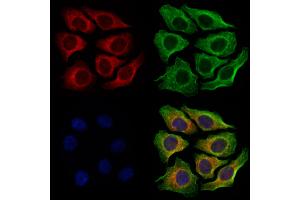 ABIN6263380 and ABIN6279011 staining Hela cells by IF/ICC. (MRPS26 Antikörper  (Internal Region))