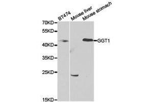 Western Blotting (WB) image for anti-gamma Glutamyltransferase 1 (GGT1) antibody (ABIN1872809)