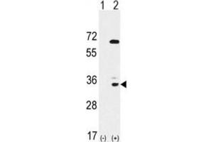 Western Blotting (WB) image for anti-EPH Receptor A10 (EPHA10) antibody (ABIN3003339) (EPH Receptor A10 Antikörper)