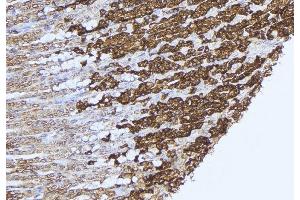 ABIN6277575 at 1/100 staining Human gastric tissue by IHC-P.