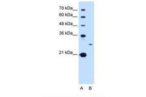Image no. 1 for anti-Tetraspanin 15 (TSPAN15) (C-Term) antibody (ABIN6738281) (Tetraspanin 15 Antikörper  (C-Term))