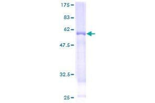 WBP2NL Protein (AA 1-309) (GST tag)