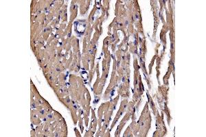 IHC analysis of heavy chain Myosin/Myh3 using anti-heavy chain Myosin/Myh3 antibody (ABIN7601735).