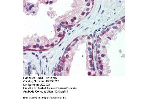 Human Prostate (NRF1 Antikörper  (Middle Region))