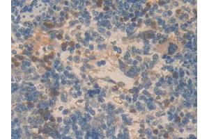 DAB staining on IHC-P; Samples: Rat Spleen Tissue (SMAD6 Antikörper  (AA 171-441))