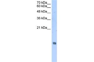 WB Suggested Anti-HIST2H2AA3 Antibody Titration:  2. (HIST2H2AA3 Antikörper  (Middle Region))