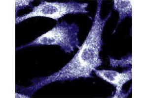 Immunofluorescence staining of human fibroblasts. (BCAR1 Antikörper  (AA 644-819))