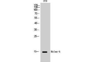 Western Blotting (WB) image for anti-Melan A (MLANA) (Internal Region) antibody (ABIN6280329)