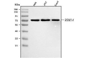 Western blot analysis of RBM14 using anti-RBM14 antibody (ABIN7599521).
