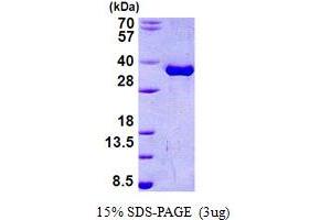 Torsin Family 1, Member A (Torsin A) (TOR1A) (AA 21-332) protein (His tag)