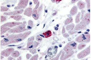 Anti-EMR3 antibody  ABIN1048549 IHC staining of human macrophage.