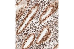 Immunohistochemical analysis of paraffin-embedded Human uterus tissue using (ABIN1537918 and ABIN2849884) performed on the Leica® BOND RXm. (MEOX2 Antikörper  (AA 164-192))