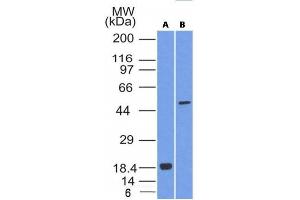 Image no. 1 for anti-SRY (Sex Determining Region Y)-Box 10 (SOX10) (AA 115-269) antibody (ABIN6181137) (SOX10 Antikörper  (AA 115-269))