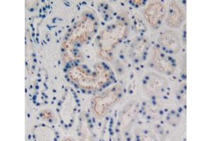 Used in DAB staining on fromalin fixed paraffin- embedded kidney tissue (KRT15 Antikörper  (AA 274-399))