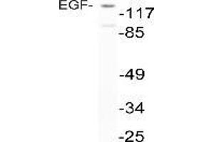 Western blot analysis of EGF in extracts from NIH-3T3 cells using anti-EGF antibody (EGF Antikörper)