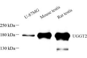 Western blot analysis of UGGT2 (ABIN7076141) at dilution of 1: 1000 (UGCGL2 Antikörper)