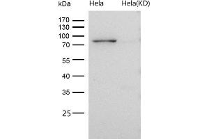 Western Blotting (WB) image for anti-Adaptor Protein, phosphotyrosine Interaction, PH Domain and Leucine Zipper Containing 1 (APPL1) antibody (ABIN7607000)
