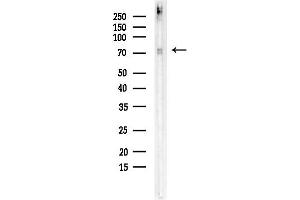 Western blot analysis of lysates from COLO205 cells, using Phospho-Lamin A/C (Ser392) Antibody at 1/1000 dilution.
