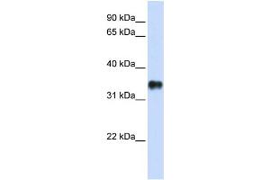WB Suggested Anti-KCTD7 Antibody Titration:  0. (KCTD7 Antikörper  (N-Term))