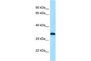 WB Suggested Anti-DSN1 Antibody Titration: 1.