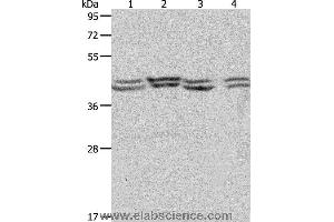 Western blot analysis of Hela, 293T, NIH/3T3 and Jurkat cell, using PSMD6 Polyclonal Antibody at dilution of 1:650 (PSMD6 Antikörper)