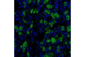 Immunofluorescence (IF) image for anti-CD68 Molecule (CD68) antibody (ABIN7449045) (Rekombinanter CD68 Antikörper)