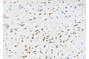 ABIN6264385 and ABIN6279691 at 1/100 staining Rat brain tissue by IHC-P.