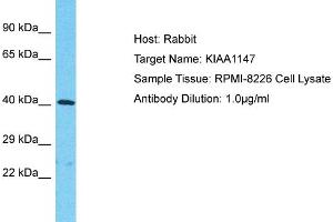 Host: Rabbit Target Name: KIAA1147 Sample Tissue: Human RPMI-8226 Whole Cell Antibody Dilution: 1ug/ml