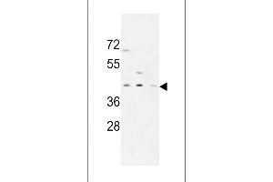 PR38A Antibody (C-term) (ABIN653884 and ABIN2843131) western blot analysis in MDA-M,CEM,HL-60 cell line lysates (35 μg/lane). (PRPF38A Antikörper  (C-Term))