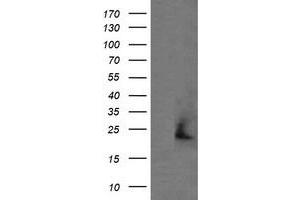 Image no. 1 for anti-Amyloid P Component, Serum (APCS) antibody (ABIN1500900)